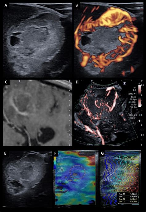 advanced ultrasound systems|Advances in Ultrasound Imaging Architecture: The .